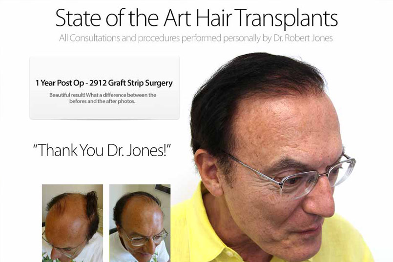 Case Study – 2912 Graft Strip Surgery on 62 Year Old Male – 1 Year post operative…