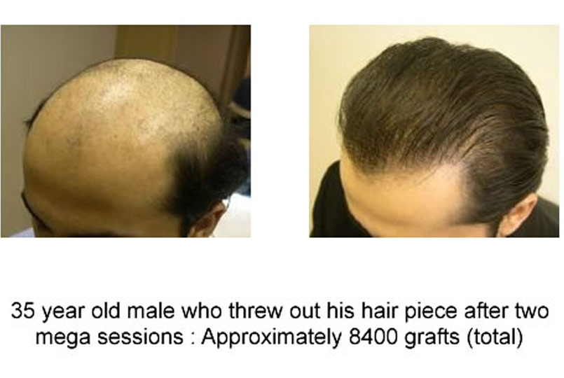 Some of the best cases handled by Dr.Jones!