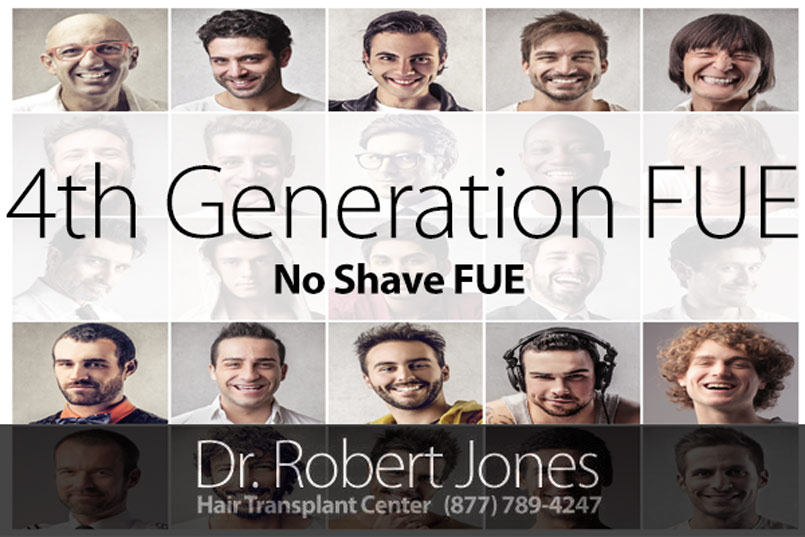 4th Generation No Shave FUE – Tell Your Story – 25% Discount for 3 Patients