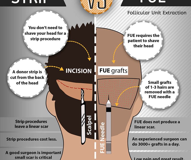 Patient Infographic: Hair Restoration Timeline – JAMES