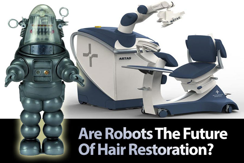 Pros & Cons of ARTAS Robotic Hair Transplants
