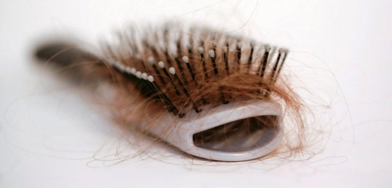 10 Things That Make Your Hair Fall Out