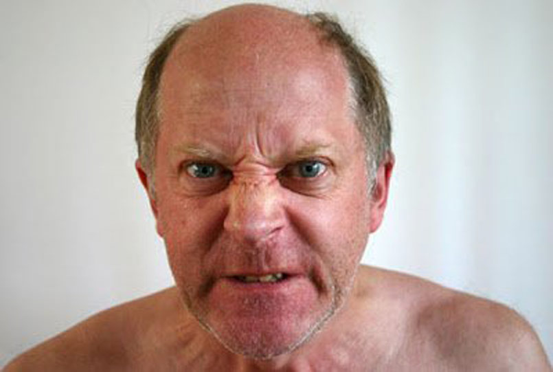 Why is the Hair Loss Community so Negative?