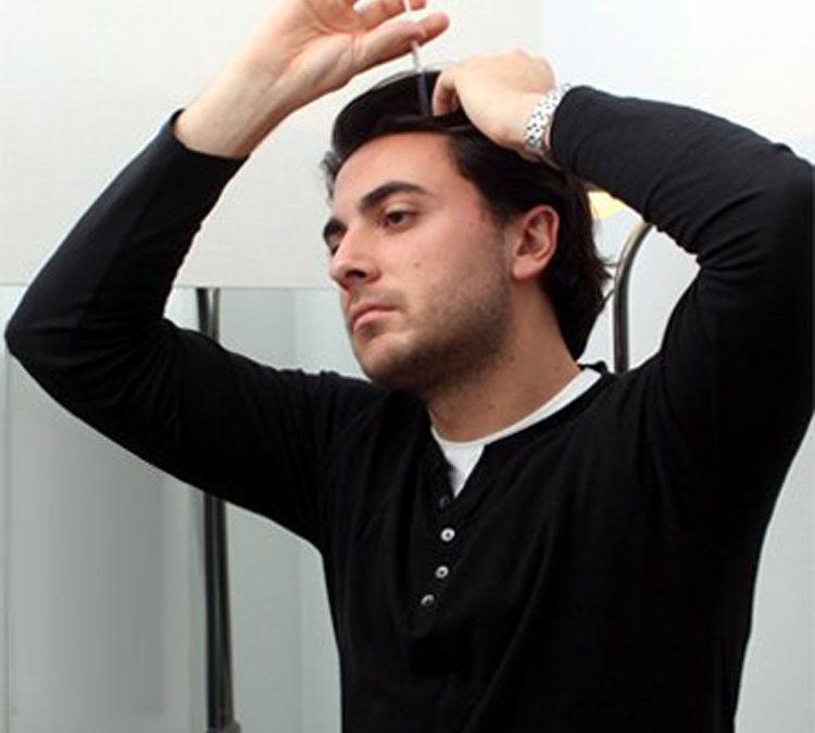 Is 12.5% Minoxidil Worth It?