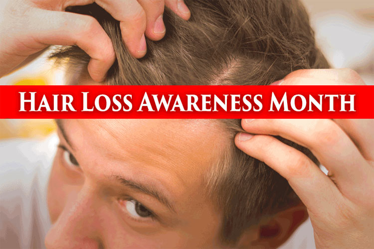 Hair Loss Awareness Month