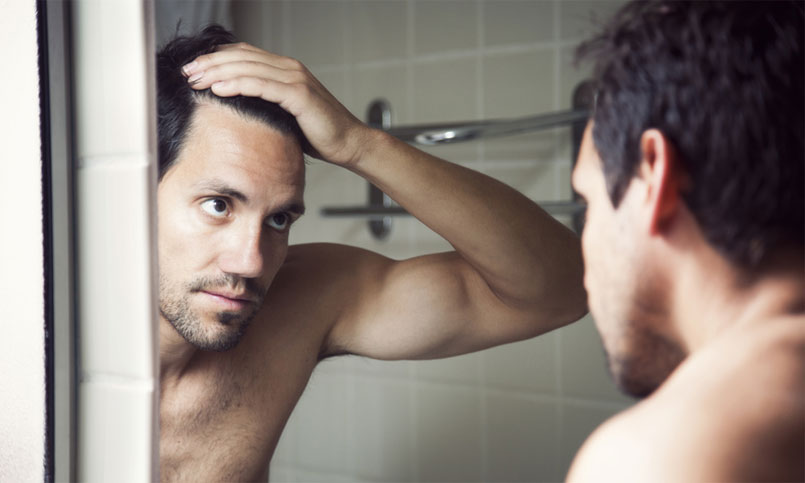 When And Why You Should Consider Having A Hair Transplant