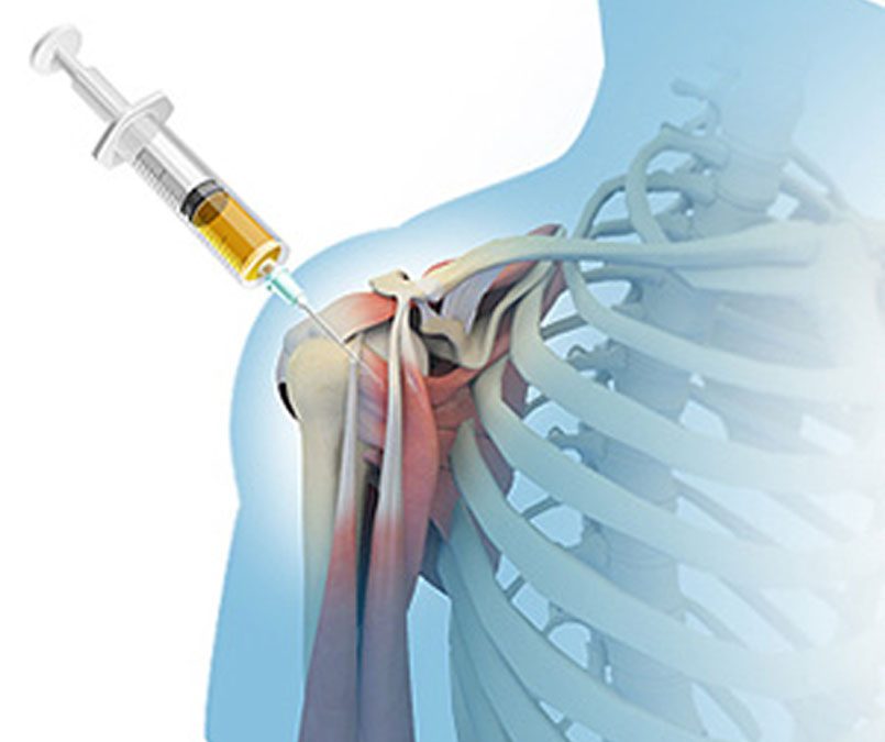 What Are PRP Injections Used For?