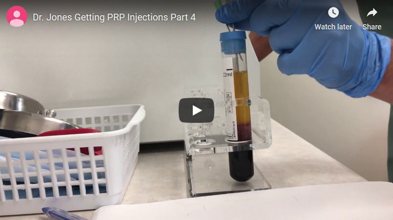 Video – Dr. Jones Gets PRP Injections