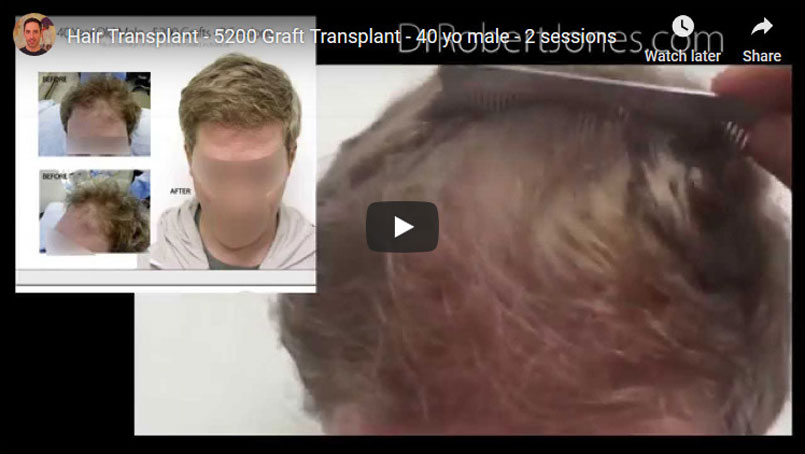 Top 10 Video Case Studies
