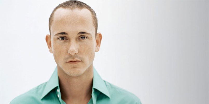 A Brief History of Hair Transplants