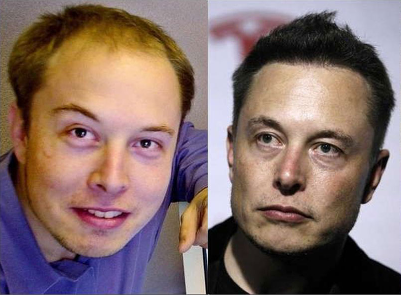 elon musk hair