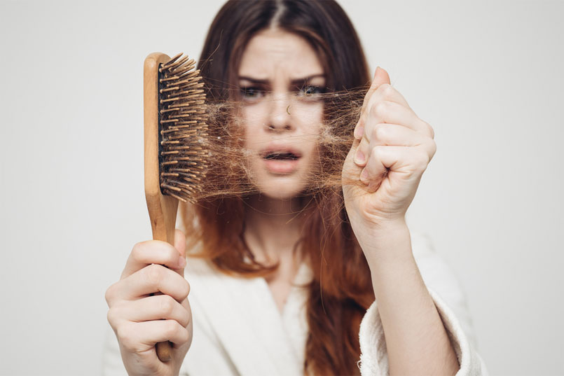 Hair Loss In Women