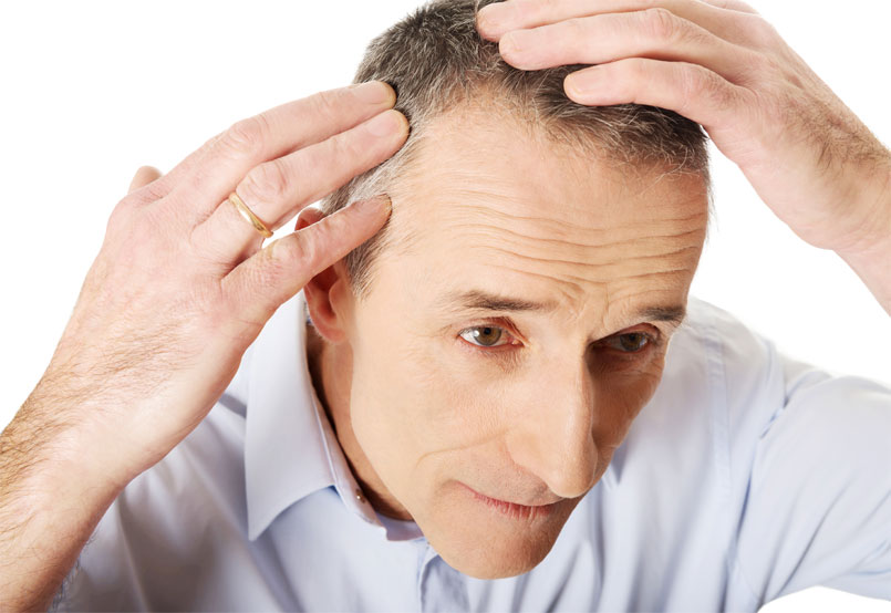 Hair Transplants Simplified